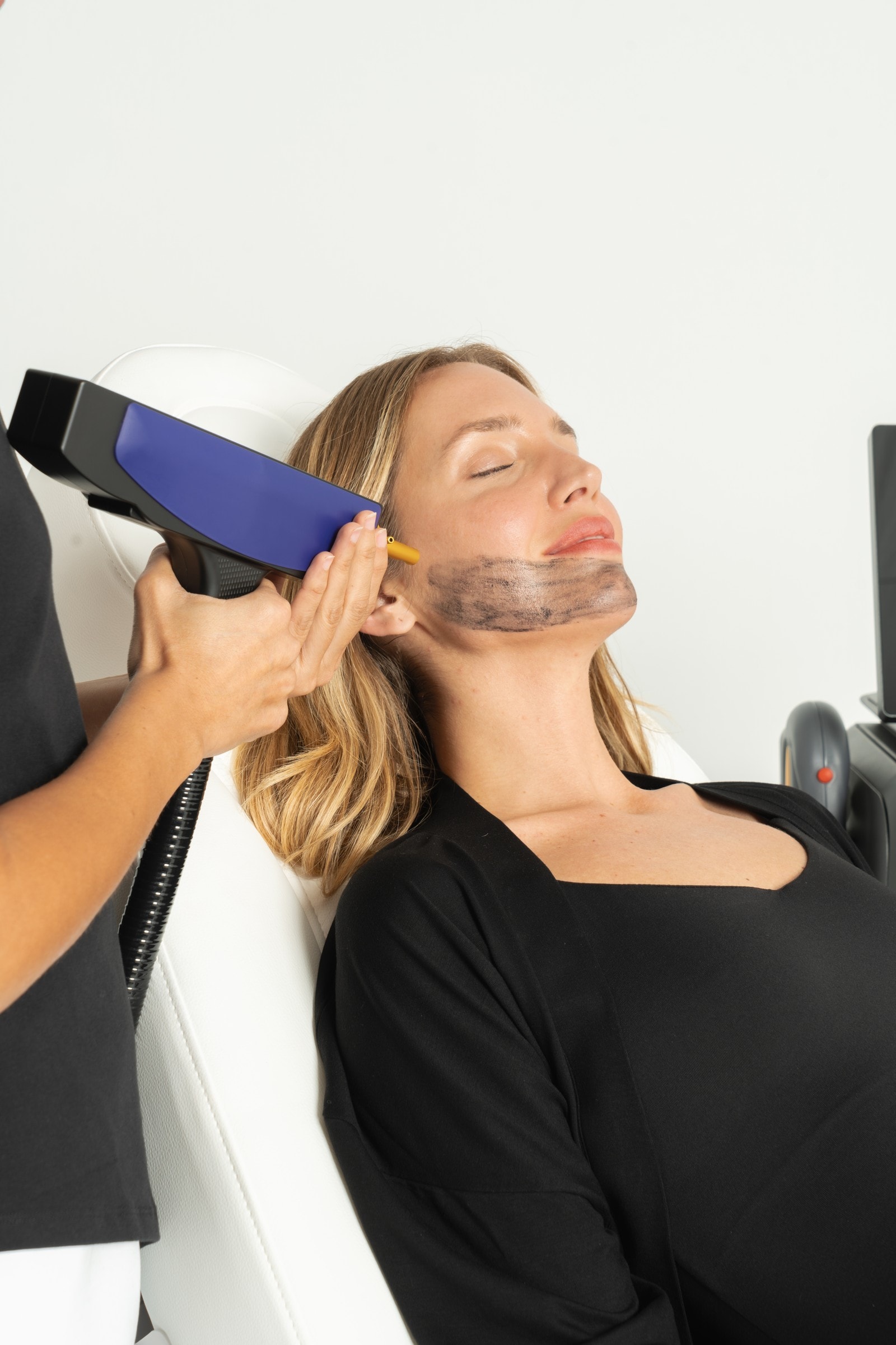 Tratamiento facial con el aplicador de la plataforma SHR X Ultra